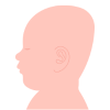 What is Flat Head Syndrome?